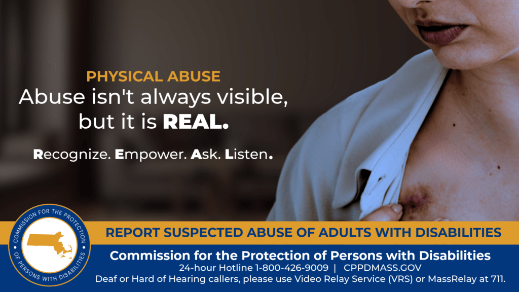 A woman holding the top of her blouse open to expose a dark bruise beneath her collarbone. Text on the left reads “Abuse isn’t always visible, but it is REAL. Recognize. Empower. Ask. Listen.” The blue and gold CPPD logo is in the bottom corner along with text that reads “24-hour Hotline 1-800-426-9009, Deaf or hard of hearing callers please use Video Relay Service (VRS) or MassRelay at 711"